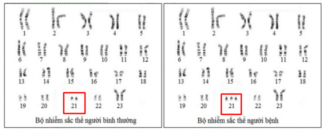 Giải bài 7 sinh 12: Thực hành Quan sát các dạng đột biến số lượng nhiễm sắc thể trên tiêu bản cố định và trên tiêu bản tạm thời